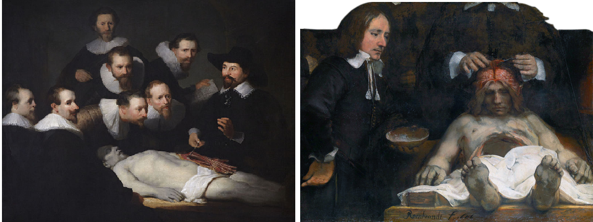 Anatomy Lesson of Dr Nicolaes Tulp by Rembrandt